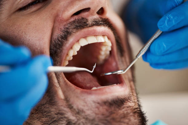 Best Dental Fillings (Composite and Amalgam)  in Twin Rivers, NJ